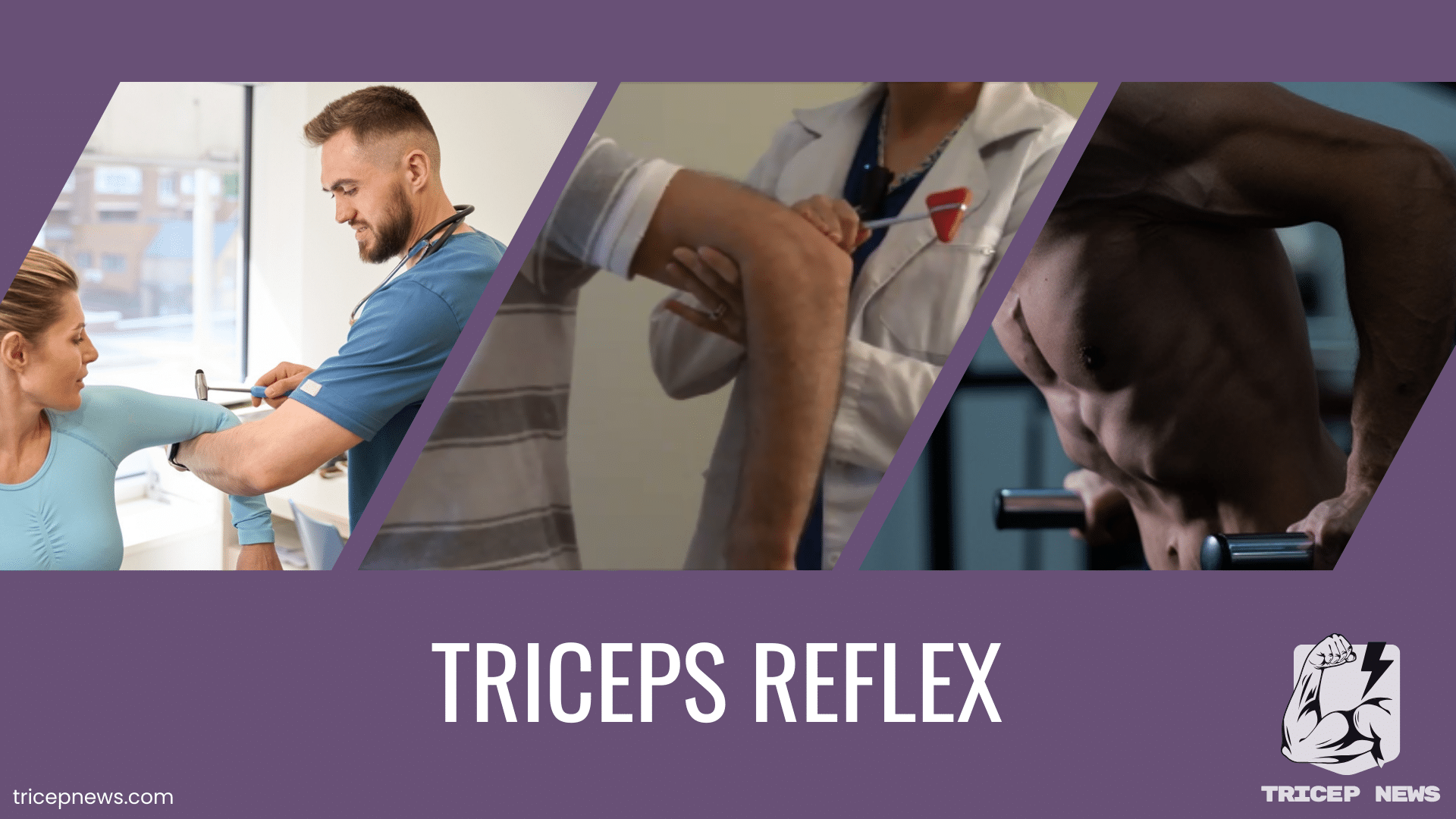 tricep reflex