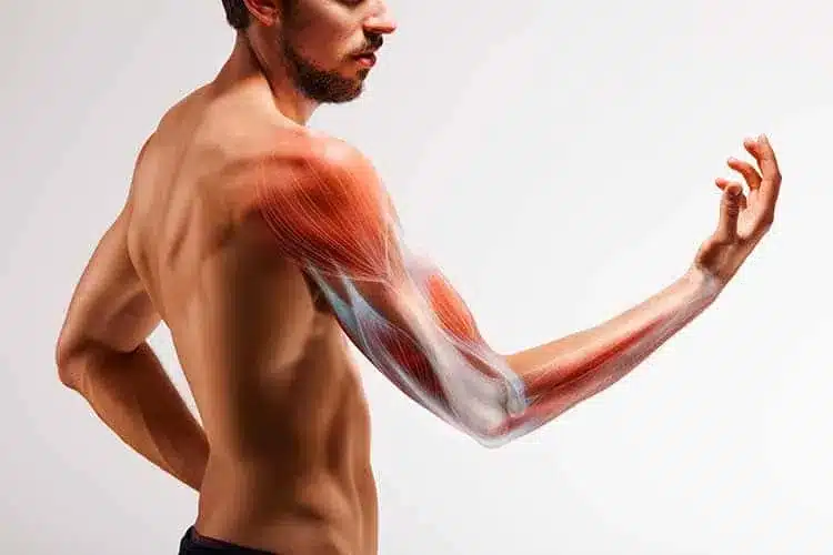 biceps triceps strain indication in a mans arm