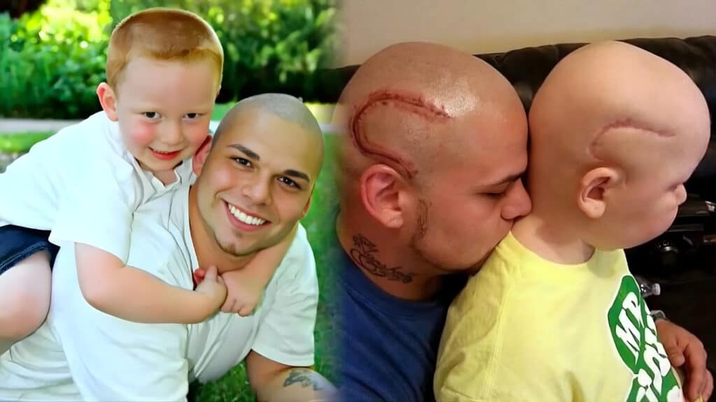 A Heart-Wrenching Story of Love and Solidarity: Father Carves the Same Scar Into His Own Head So His Son Would Never Feel Alone